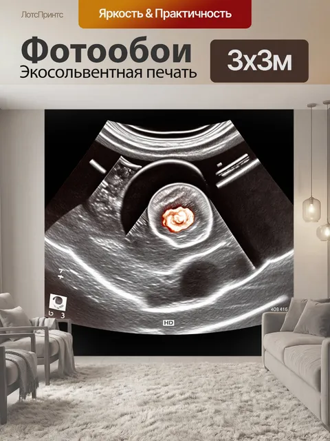 Фотообои нежное изображение среза плода на ультразвуковом снимке