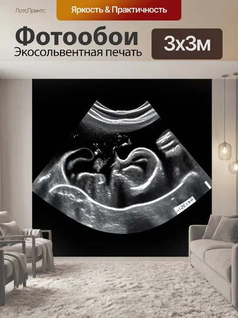 Фотообои узи-сканирование органов брюшной полости, выполненное в стиле минимализма с использованием ярких акцентов