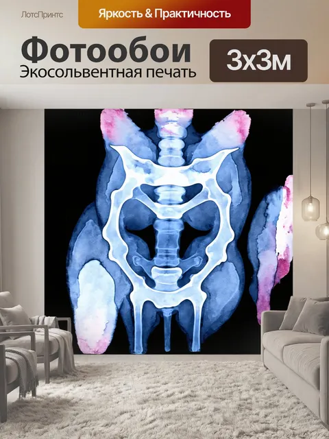Фотообои снимок рентгенограммы тазовых костей кошки