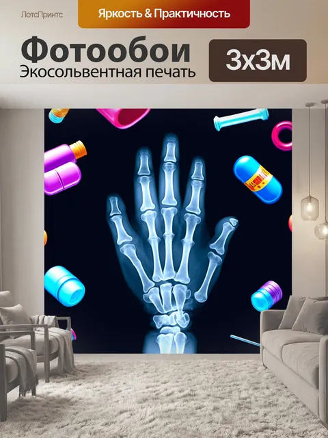 Фотообои изображение рентгеновского снимка руки
